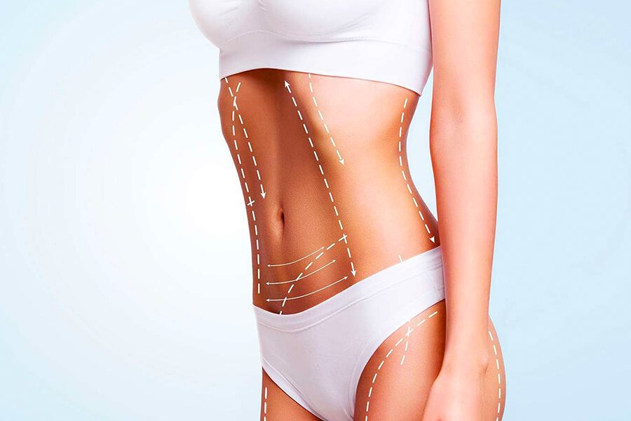 Below Knee BBL/Liposuction/Tummy Tuck Corset