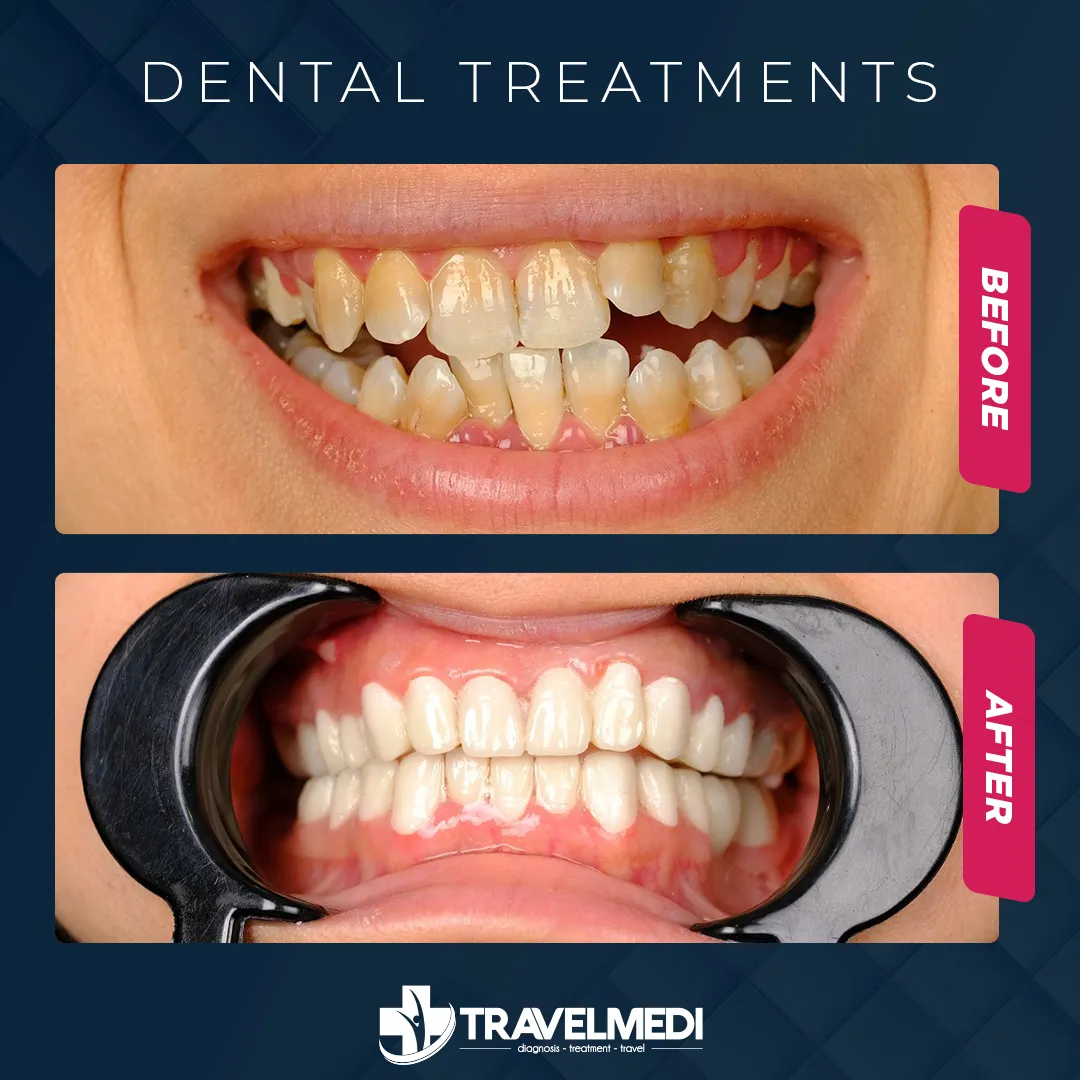 Dentistry in Turkey TravelMEDI